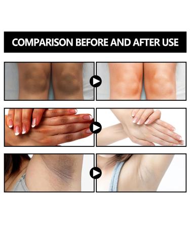 Restorative Acanthosis Nigricans Soap | Basho 100g Treatment for Light Skin Dark Areas - Face Neck & Armpit - Buy Online on GoSupps.com