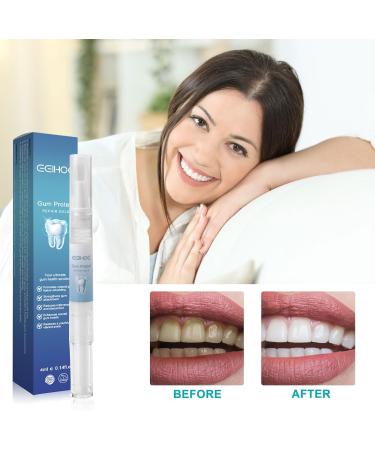 VQBKHO 5 Pieces Gum Therapy Gel Gum Relief Periodontal Treatment Gel Teeth Periodont Gum Care Whitening Essence Tooth Whitening Stick White Teeth Pen Tooth Stain Remover - Buy Online on GoSupps.com