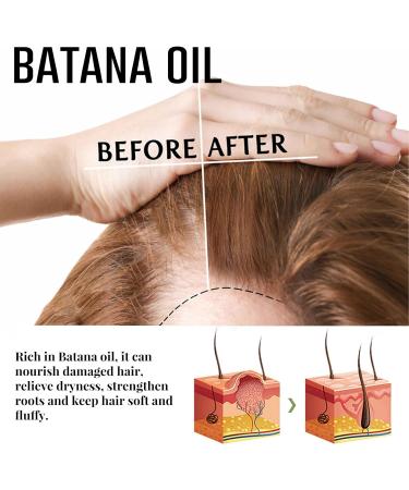 Batana Oil Roll-On Liquid For Hair Growth 20ml Denser Fuller Healthier Hair Oil Nourish Damag Hair Roll-On Liquid 20ml Batana Oil Roll-on Liquid For Hair Growth Nourish Damaged Hair Oil - Buy Online on GoSupps.com