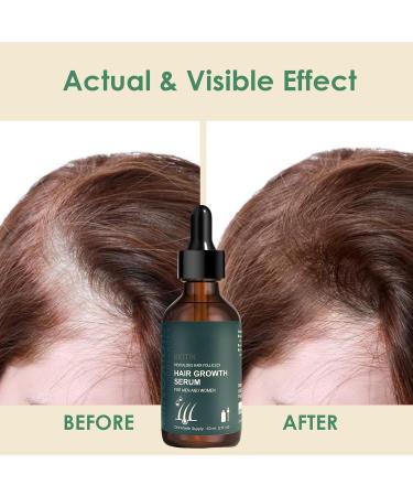 Huile nourrissante pour cheveux et cuir chevelu 60 ml - Buy Online on GoSupps.com
