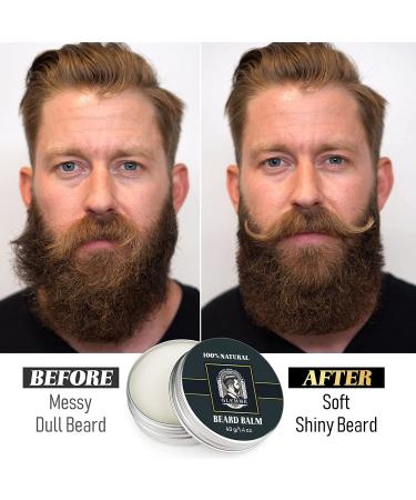 5% Minoxidil Beard Growth Kit with Derma Roller and Growth Oil for Men - 0.25mm Microneedle Roller for Patchy Beard Growth - Buy Online on GoSupps.com
