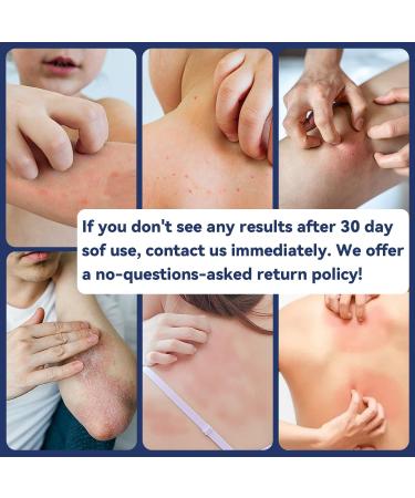 Manuka Honey Eczema Balm - Soothing Relief for Psoriasis Rashes Itchy Skin | 2 Fl Oz (Pack of 6) - Ideal for Kids & Adults - Buy Online on GoSupps.com
