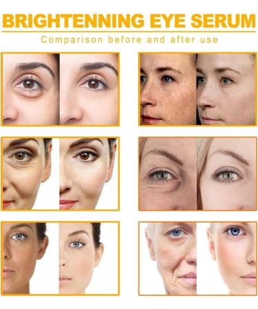 ieron 2pcs Natural Turmeric Oil Skin Care Fights Acne Heals Scars Turmeric Facial Serum Turmeric Serum for Dark Spots 10ml - Buy Online on GoSupps.com