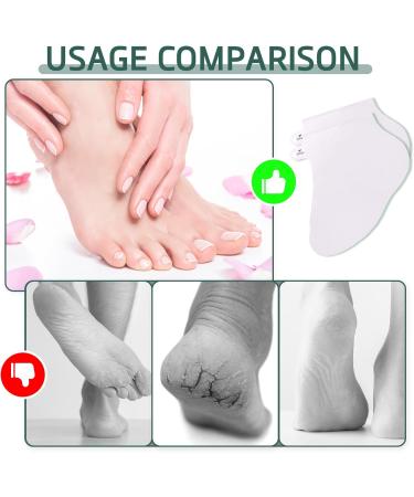 Foot Peel Mask 2 Pairs Exfoliating Foot Peeling Mask Socks for Hard Skin Callus Remove Repair Cracked Heel & Dead Dry Skin Foot Care Baby-Soft Feet Skin - Buy Online on GoSupps.com