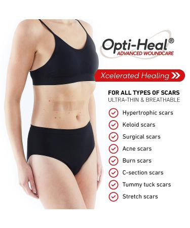 Neo G Opti-Heal Silicone Scar Strips for Surgical, C-Section, Burn, Acne, Keloid Treatment - 6 Strips - 1.6 x 5.9 inch - Medical Grade Scar Sheets - Buy Online on GoSupps.com