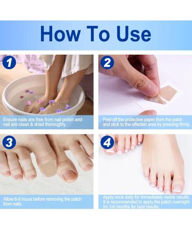 Fungal Nail Treatment - Extra Strong Toe Nail Repair Patches for Damaged Nails - 8 Hour Nail Repair Restores Healthy Nails - Buy Online on GoSupps.com