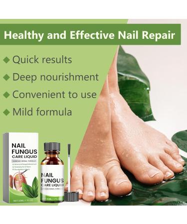 Toenail Care with Nail File Nourishing and Soothing for Nails Promotes the Regrowth of Healthy Nails 30ml - Buy Online on GoSupps.com