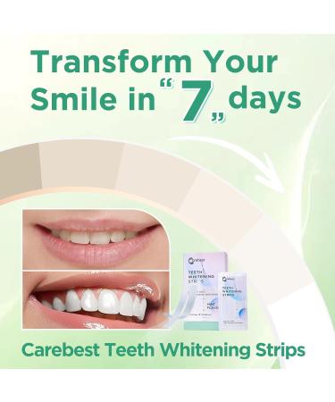 Teeth Whitening Strips for Sensitive Teeth - Professional Home Kit | 36 Mint Strips - Buy Online on GoSupps.com