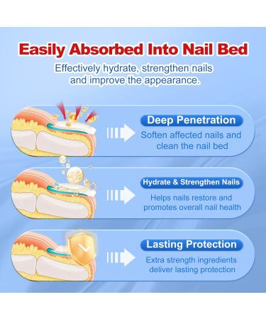 Buy Extra Strength Toenail Fungus Treatment - Fast Acting Nail Fungus Remover for Men & Women - 30mL Liquid Solution - Buy Online on GoSupps.com