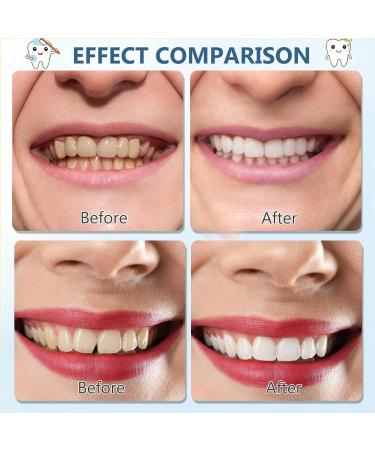 2 Paires Proth se Dentaire Cosm tique Dentier Sourire Parfait Instantan es Fausse Dent Naturel A Poser Dentier Sourire Parfait Sup rieurs Et Inf rieurs Pour Homme Femme - Buy Online on GoSupps.com