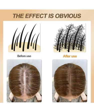  sularpek Sularpek Hair Powder Instantly Conceals Hair Loss Ombre Powder for Thinning Hair for Men and Women Eyebrows Beard Line Me - Buy Online on GoSupps.com