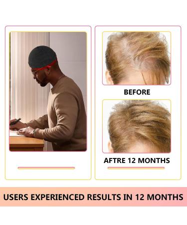 iKeener Laser Hair Regrowth Cap (FDA Cleared) - Red & Blue Light Hair Loss Treatment for Men and Women - Full Scalp Coverage LED Hat for Thinning Hair & Balding - Buy Online on GoSupps.com