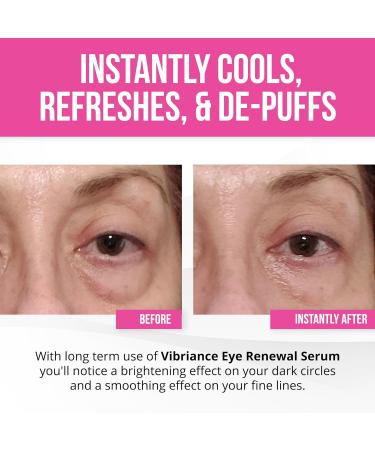 Vibriance Eye Renewal Serum Dark Circles and Puffiness Treatment Caffeine Formula for Reducing Bags - 0.5 Fl Oz - Buy Online on GoSupps.com