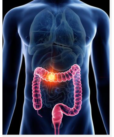 Organic Body Cleanse - Detoxify & Revitalize | International Shipping Available - Buy Online on GoSupps.com