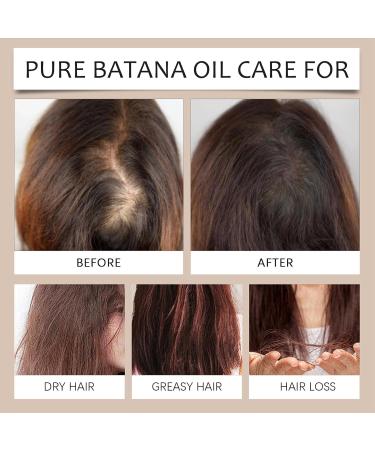 Organic Batana Oil for Hair - Natural Haircare for Thicker Longer Softer & Glossy Hair - 1fl.oz - Buy Online on GoSupps.com