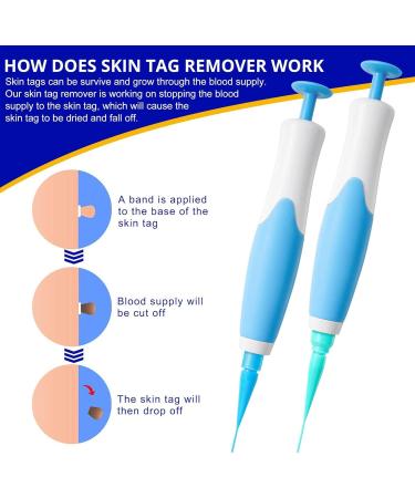GIMOCOOL Auto Skin Tag Remover kit Skin Tag Treatment Anti-skin Tag Pen Skin Wart Removal Device 2-8mm 2 in 1 for Removing Face Body Warts - Buy Online on GoSupps.com