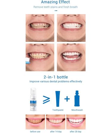 Mousse Whitening & Strengthening Teeth | Fresh Breath & Tartar Removal - International Shipping - Buy Online on GoSupps.com