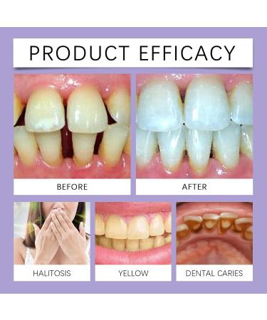 Kit de Bandes Blanchiment Dentaire Bandes Blanchissantes Dents limine Taches Caf /Th /Vin R sultats Visibles Rapidement Sans Sensibilit Blanchiment Dentaire Douces (2) - Buy Online on GoSupps.com
