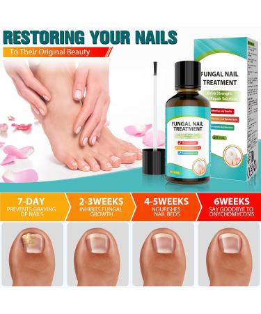 Nail Fungus Treatment Quick Intensive Agent Against Nail Polish Against Nail Fungus for Fingernails and Toenails Tea Tree Oil - Cyan Blue - 1 Fl Oz - Buy Online on GoSupps.com