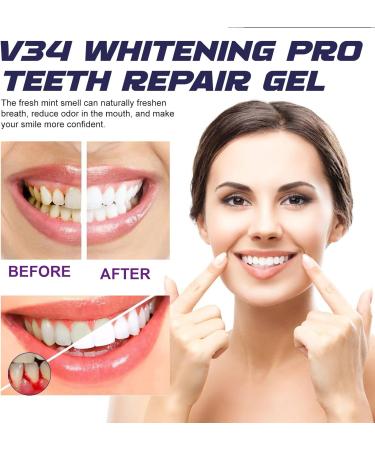 KOAHDE Dental Gel Pen Gum Repair Gel Pen Dentizen Gum Therapy Gel Gum Shield Therapy Gel Gum Pen Dental Rinse Gum Regrowth Gel Pen Deep Cleans Teeth Gel Pen Gingivaease Gum Pen Gel 4ML 1PC - Buy Online on GoSupps.com