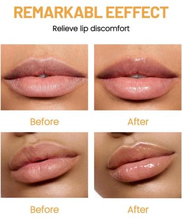 6pcs Fruit Flavored Lip Gloss Set Clear Lip Gloss for Dry and Chapped Lips Long Lasting Moisturizing Lip Gloss Lip Balm Fruit Lip Balm Set - Buy Online on GoSupps.com