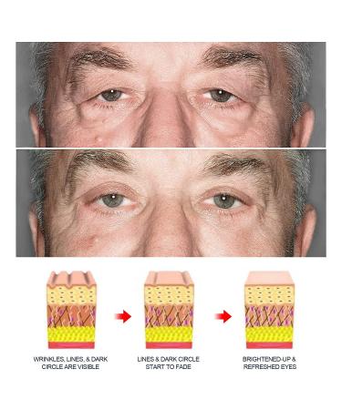 3PCS OPENEYES Awaken Peptide Lifting Eye Gel - Depuffing & Firming Serum for Eye Bags, Dark Circles, and Wrinkles - Buy Online on GoSupps.com