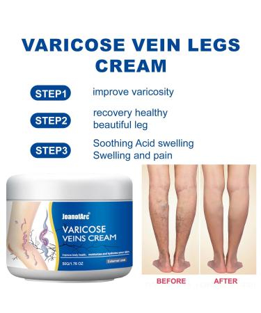 JoanofArc Varicose Veins Repair Cream Reduces Spider Veins & Leg Heaviness Soothing for Legs 50g - Buy Online on GoSupps.com