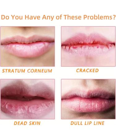 Lip Balm Propolis Lip Scrub Gel Lips Exfoliating Scrub Gel Lip Scrub Exfoliator Moisturizing Repair Lip Dead Skin Gel Lip Lightening for Dark Lips Nursing Lip Dead Skin Gel Overnight Lip Treatment - Buy Online on GoSupps.com