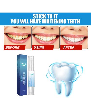 Sky Blue Teeth Whitening Pen: Instant Whitening Gel for Stain Removal and Teeth Brightening - Buy Online on GoSupps.com