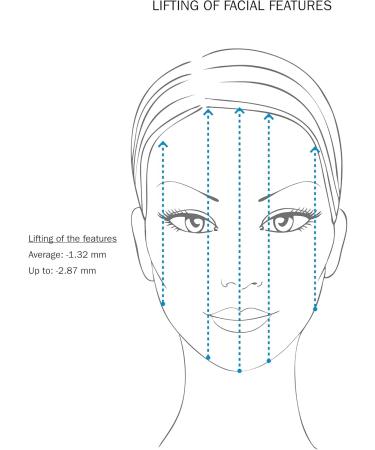 Fillerina Dermo Cosmetic Filler Treatment Grade 2 - Buy Online on GoSupps.com