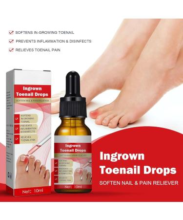 Ingrown Toenail Treatment Nail Growth Ingrowing Toenail Treatment Nail Helper Fungal Nail Treatment Correction Oil Drops Ingrown Toenail Corrector Toe Nail Fungus Treatment Cuticle Oil - Buy Online on GoSupps.com