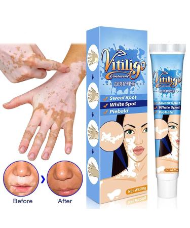 Vitiligo Therapy Cream: Soothing Ointment to Reduce White Spots & Improve Skin Pigmentation - Buy Online on GoSupps.com