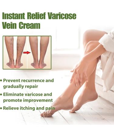 Varicose Vein Repair Cream for Effective Treatment of Varicose Veins Treatment Legs Cream Soothes and Moisturizes Quickly Cr me r paratrice veineuse (vert) / - Buy Online on GoSupps.com