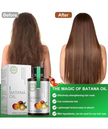 ACAREY Batana oil for hair cold pressed 100 ml hair growth natural acceleration Batana Oil Organic with scalp massage brush for moisturizing and repairing dry damaged hair 2 2 pieces - Buy Online on GoSupps.com