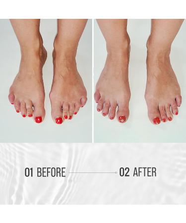 Toe Spacers - One Size Fits All | Reusable Silicone Correctors for Bunion & Hammer Toe | Yoga Toe Spreaders for Perfect Alignment - Buy Online on GoSupps.com