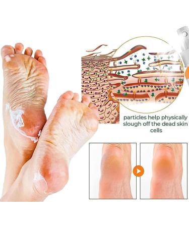 2PC Foot Callus Removal Spray - Instant Dead Skin & Callus Peeling with Orange Oil - 30ml - Fast International Shipping - Buy Online on GoSupps.com