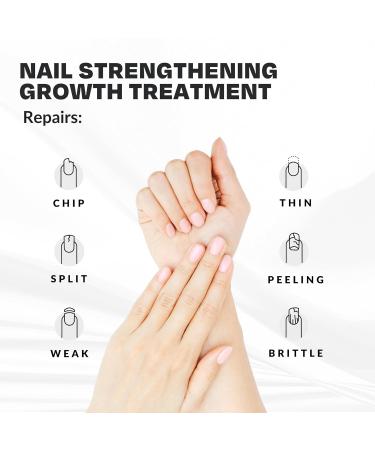 CAKE Nail Nail Strengthener Power Boost Growth - Clear - 0.50 Fl Oz. - Buy Online on GoSupps.com