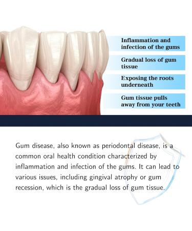 Aexzr Shark Cartilage Protein Dental Care Drops | Gum & Tooth Regrowth & Whitening | 5PC Stain Removal Serum - Buy Online on GoSupps.com