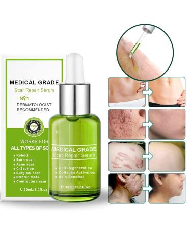 Goopgen Advanced Medical Grade Scar Repair Serum - Scar Treatment for Scar Removal (3pcs) - Buy Online on GoSupps.com