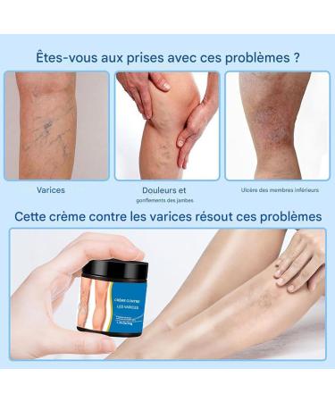 Leg Care Cream | Natural Calf Cream 50g Natural Nourishing Lotion for Pregnant Women Men Sports Events Family Travel Hiking Outdoors - Buy Online on GoSupps.com