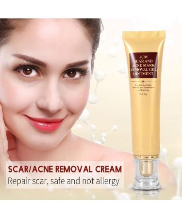 30g Scar Removal Cream for Acne Marks, Pimple, Blemishes, Stretch Marks, Burns - Treatment Ointment - Buy Online on GoSupps.com