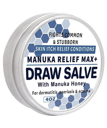 Max Strength Treat Natural Organic Manuka Honey Cream Ointment Soothing Relief for Dry Heat Rash Hidradenitis Itchy Eczema Psoriasis Leg Belly Armpit Foot Hand Irritable Skin For All Ages