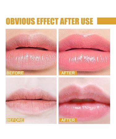 Lime & Watermelon Lip Balm | Exfoliating Moisturizer for Dry Cracked Lips | Honey Lip Care | Reduce Lip Lines & Lighten Lips - Buy Online on GoSupps.com