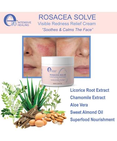 Rosacea Solve Redness Relief Cream - Calming Face Moisturizer for Sensitive Skin - Organic Ingredients with Aloe Vera, Almond Oil, Licorice & Chamomile Extracts - Buy Online on GoSupps.com