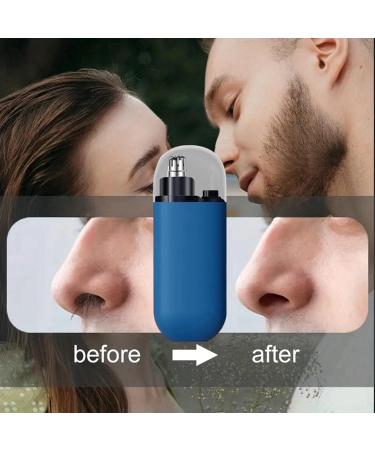 Portable Nose Hair Trimmer Nose Hair Trimmer for Men Ear and Nose Hair Trimmer for Men Painless Nasal Hair Trimmer Rechargeable Ear Trimmer Ear Hair Trimmers for Men Women Mens Facial Hair Trimmer - Buy Online on GoSupps.com