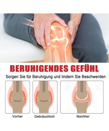 New Zealand Bee Venom Joint Cream - Pain Relief for Back Ankle Joint & Muscle Discomfort | Bienengift Salbe - Buy Online on GoSupps.com