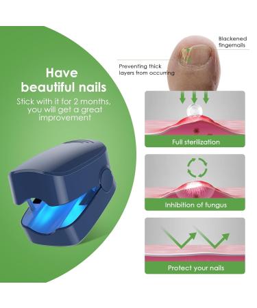 Home-Use Nail Fungus Laser Device with LED Blue Light Therapy - Buy Online on GoSupps.com