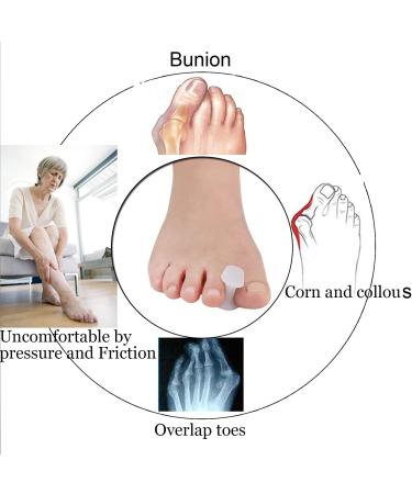 10 Pieces Gel Toe Bunion Toe Spacers Toe Corrector and Straightener Orthotics for Bunion Overlapping Toes  Bunion Toe Pain Relief - (L Size) - Buy Online on GoSupps.com