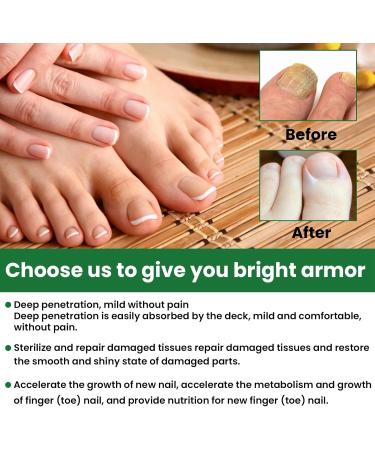 MrCuvaryas Nail Serum for Toenails Extra Strong - Buy Online on GoSupps.com