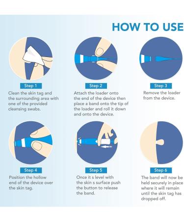 Skin Tag Remover Device 40x Removal Bands for Fast & Effective Wart Removal - 2-8mm - Buy Online on GoSupps.com